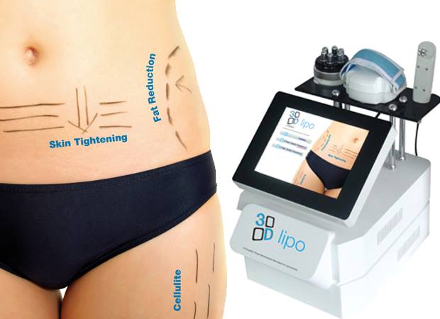 lipo lipo